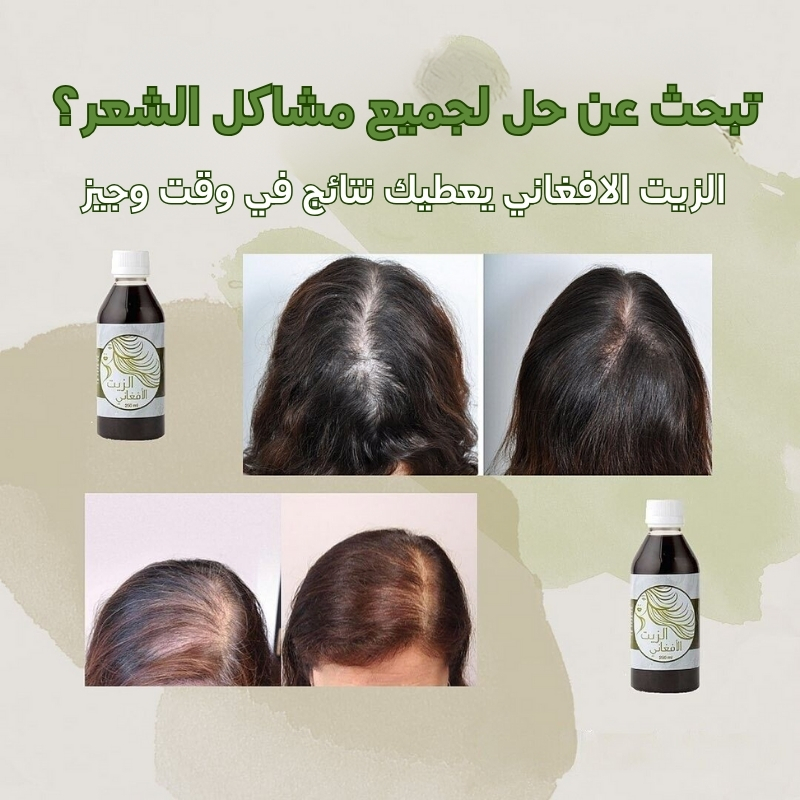 الزيت الأفغاني الاصلي الرقم 1 لعلاج مشاكل الشعر وتقويته من الجذور